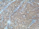 D2HGDH Antibody in Immunohistochemistry (Paraffin) (IHC (P))