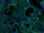 STARD8 Antibody in Immunocytochemistry (ICC/IF)