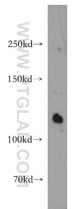 STARD8 Antibody in Western Blot (WB)