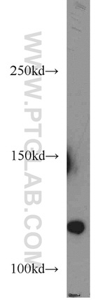 STARD8 Antibody in Western Blot (WB)