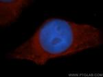 HPS5 Antibody in Immunocytochemistry (ICC/IF)
