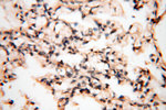 HPS5 Antibody in Immunohistochemistry (Paraffin) (IHC (P))