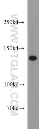 HPS5 Antibody in Western Blot (WB)