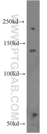 HPS5 Antibody in Western Blot (WB)