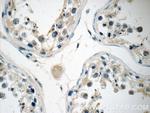 KLHDC3 Antibody in Immunohistochemistry (Paraffin) (IHC (P))