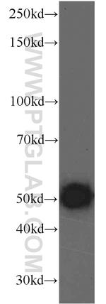 KLHDC3 Antibody in Western Blot (WB)
