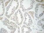 KLHDC3 Antibody in Immunohistochemistry (Paraffin) (IHC (P))
