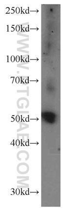 KLHDC3 Antibody in Western Blot (WB)