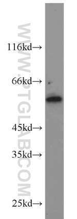 KLHDC3 Antibody in Western Blot (WB)