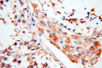 AKAP3 Antibody in Immunohistochemistry (Paraffin) (IHC (P))