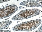 AKAP3 Antibody in Immunohistochemistry (Paraffin) (IHC (P))
