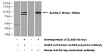 SLAIN2 Antibody in Western Blot (WB)