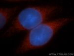 ADAP1 Antibody in Immunocytochemistry (ICC/IF)