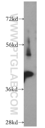 ADAP1 Antibody in Western Blot (WB)