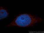 ADAP1 Antibody in Immunocytochemistry (ICC/IF)