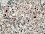 ADAP1 Antibody in Immunohistochemistry (Paraffin) (IHC (P))