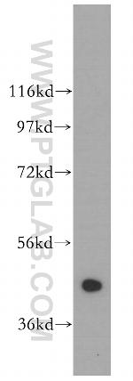 ADAP1 Antibody in Western Blot (WB)