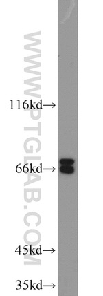SPAG8 Antibody in Western Blot (WB)