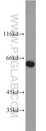 SPAG8 Antibody in Western Blot (WB)