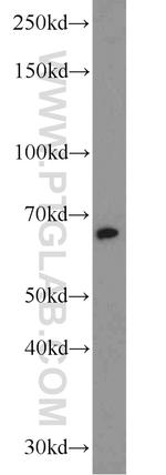 SPAG8 Antibody in Western Blot (WB)