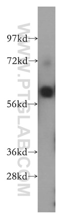 SPAG8 Antibody in Western Blot (WB)