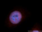 RBM17 Antibody in Immunocytochemistry (ICC/IF)