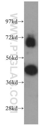 RBM17 Antibody in Western Blot (WB)