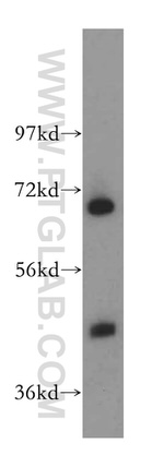 RBM17 Antibody in Western Blot (WB)