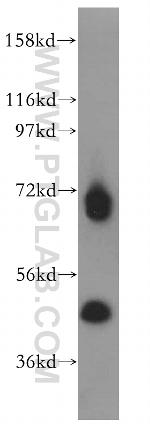 RBM17 Antibody in Western Blot (WB)