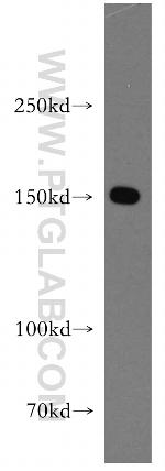 DHX29 Antibody in Western Blot (WB)