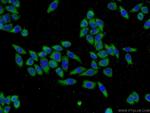 MTM1 Antibody in Immunocytochemistry (ICC/IF)