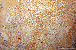 MTM1 Antibody in Immunohistochemistry (Paraffin) (IHC (P))