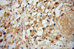 MTM1 Antibody in Immunohistochemistry (Paraffin) (IHC (P))