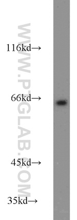 MTM1 Antibody in Western Blot (WB)