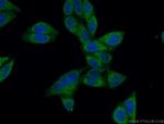 NPC1 Antibody in Immunocytochemistry (ICC/IF)