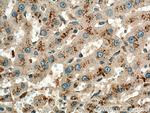 NPC1 Antibody in Immunohistochemistry (Paraffin) (IHC (P))