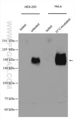 NPC1 Antibody in Western Blot (WB)