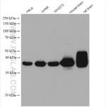GNAQ Antibody in Western Blot (WB)