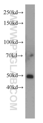 TSPYL1 Antibody in Western Blot (WB)