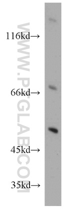 TSPYL1 Antibody in Western Blot (WB)