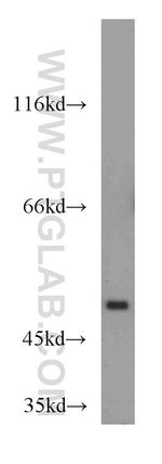 TSPYL1 Antibody in Western Blot (WB)