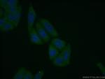FBXL14 Antibody in Immunocytochemistry (ICC/IF)