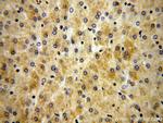 FBXL14 Antibody in Immunohistochemistry (Paraffin) (IHC (P))
