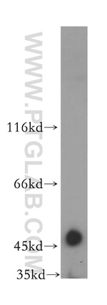 FBXL14 Antibody in Western Blot (WB)