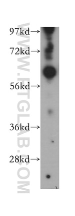 WARS2 Antibody in Western Blot (WB)