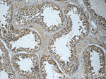 EMB Antibody in Immunohistochemistry (Paraffin) (IHC (P))