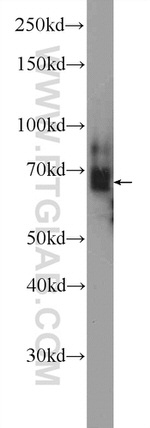 EMB Antibody in Western Blot (WB)