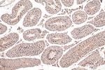 EMB Antibody in Immunohistochemistry (Paraffin) (IHC (P))