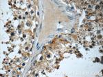 EMB Antibody in Immunohistochemistry (Paraffin) (IHC (P))