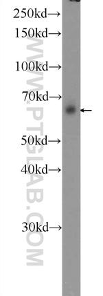 EMB Antibody in Western Blot (WB)